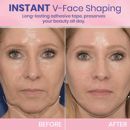 V-Face👑 Lifting Invisible Adhesive Tape